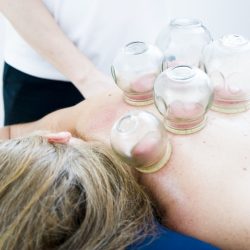 cupping therapy, cupping massage, massage-6604217.jpg